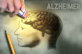 Alzheimer-Disease-Caalzheimer